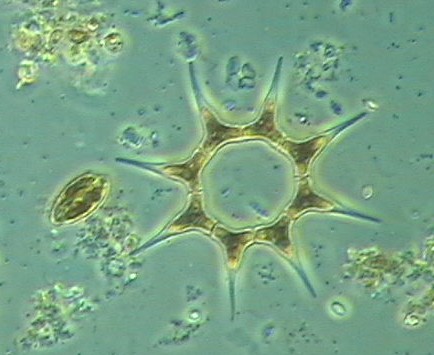 Pediastrum simplex